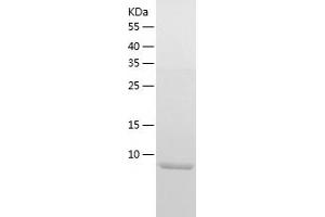 Western Blotting (WB) image for Defensin beta 4 (DEFB4) (AA 23-63) protein (His-IF2DI Tag) (ABIN7121995)