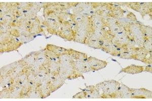 Immunohistochemistry of paraffin-embedded Rat heart using HK2 Polyclonal Antibody at dilution of 1:200 (40x lens). (Hexokinase 2 anticorps)