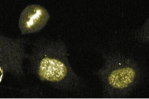 Immunofluorescence staining of human endothelial cells. (Aurora Kinase B anticorps  (AA 2-124))