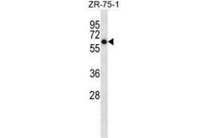 ARSD Antibody (C-term) western blot analysis in ZR-75-1 cell line lysates (35µg/lane).