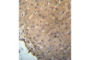 CHB Antibody (N-term) (ABIN657226 and ABIN2846328) immunohistochemistry analysis in formalin fixed and paraffin embedded human liver tissue followed by peroxidase conjugation of the secondary antibody and DAB staining. (CHMP2B anticorps  (N-Term))