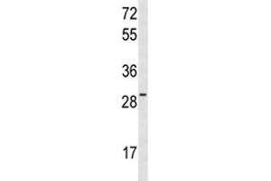 Western blot analysis of HES6 antibody and MCF-7 lysate.