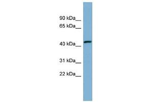 WB Suggested Anti-EFCAB4B Antibody Titration:  0. (EFCAB4B anticorps  (Middle Region))