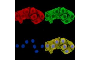 ABIN7095903 and ABIN7099965 staining Hela cells by IF/ICC. (PAN3 anticorps)