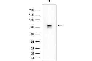 anti-Katanin P60 Subunit A-Like 2 (KATNAL2) antibody