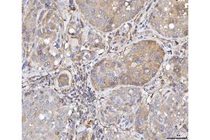 IHC analysis of TTC11/FIS1 using anti-TTC11/FIS1 antibody (ABIN7600321). (Fission 1 anticorps  (AA 18-152))