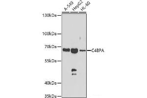 Western blot analysis of extracts of various cell lines using C4BPA Polyclonal Antibody at dilution of 1:1000.