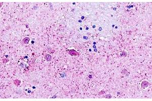 Human, Brain, neurons: Formalin-Fixed Paraffin-Embedded (FFPE