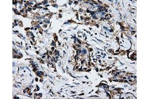 Immunohistochemical staining of paraffin-embedded liver tissue using anti-ATP5Bmouse monoclonal antibody. (ATP5B anticorps)