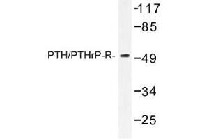 Image no. 1 for anti-Parathyroid Hormone 1 Receptor (PTH1R) antibody (ABIN317698)