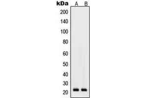 Western blot analysis of RhoD expression in K562 (A), Raw264.