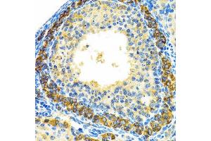 Immunohistochemistry of paraffin-embedded rat ovary using MRPL28 antibody.