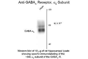 Western Blot of Anti-GABA(A) Receptor alpha 4 (Rabbit) Antibody - 612-401-D47 Western Blot of Anti-GABA(A) Receptor alpha 4 (Rabbit) Antibody. (GABRA4 anticorps  (Cytoplasmic Loop))
