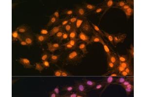 Immunofluorescence analysis of C6 cells using Snail Polyclonal Antibody at dilution of 1:100.