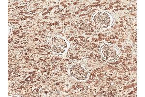 Immunohistochemistry analysis using Rabbit Anti-FNP1 Polyclonal Antibody (ABIN5066849).