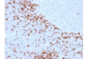 Formalin-fixed, paraffin-embedded human Lymph Node stained with IgD Mouse Monoclonal Antibody (IGD26). (IgD anticorps)