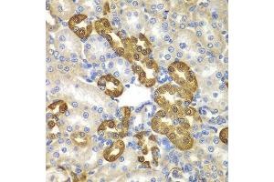 Immunohistochemistry of paraffin-embedded rat kidney using MAP1LC3B antibody at dilution of 1:100 (x400 lens). (LC3B anticorps)