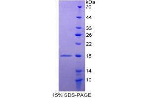 SDS-PAGE analysis of Rat Agouti Related Protein.