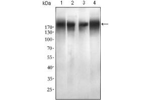 Western blot analysis using EGFR mutant antibody against SPC-A-1 (1), A549 (2), HepG2 (3) and MCF-7 (4) cell lysate. (EGFR Mutant (AA 693-893), (Mutant) anticorps)