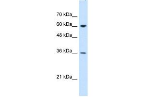 WB Suggested Anti-STIP1 Antibody Titration:  1. (STIP1 anticorps  (N-Term))