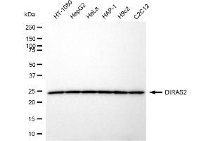Western blotting analysis using DIRAS2 antibody (ABIN7798350).