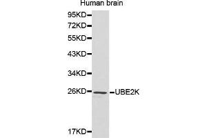 Western Blotting (WB) image for anti-Ubiquitin-Conjugating Enzyme E2K (UBE2K) (AA 1-100) antibody (ABIN6215017) (UBE2K anticorps  (AA 1-100))