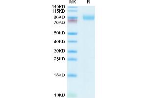Mouse E-selectin on Tris-Bis PAGE under reduced conditions. (Selectin E/CD62e Protein (AA 22-557) (His tag))