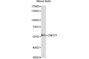 Western blot analysis of extracts of mouse testis, using ZNF177 antibody. (ZNF177 anticorps)