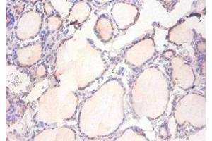 Immunohistochemistry of paraffin-embedded human thyroid tissue using ABIN7150042 at dilution of 1:100 (ADAM15 anticorps  (AA 207-452))