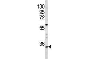 Western blot analysis of HOXA9 antibody and A2058 lysate.