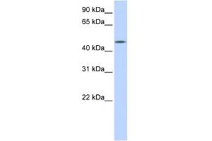 WB Suggested Anti-C20orf160 Antibody Titration: 0. (C20orf160 anticorps  (N-Term))