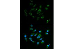 Immunofluorescence analysis of MCF7 cell using TYR antibody. (TYR anticorps)