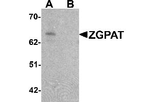 Western blot analysis of ZGPAT in SK-N-SH cell lysate with ZGPAT antibody at 1 µg/mL in (A) the absence and (B) the presence of blocking peptide. (ZGPAT anticorps  (C-Term))