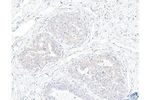 Immunohistochemistry (IHC) image for anti-Ubiquitin Protein Ligase E3 Component N-Recognin 4 (UBR4) (AA 5133-5183) antibody (ABIN7453830)