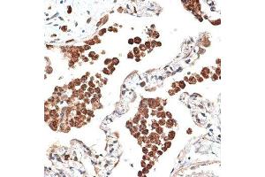 Immunohistochemistry of paraffin-embedded human lung using KTN1 antibody. (KTN1 anticorps  (AA 1-100))