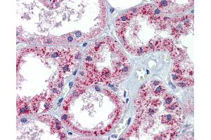 Immunohistochemistry (IHC) image for anti-Patched 1 (PTCH1) (C-Term) antibody (ABIN2773841)