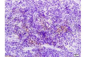 Formalin-fixed and paraffin embedded rat spleen labeled with Anti-Sema3F/semaphorin 3F Polyclonal Antibody, Unconjugated (ABIN737976) at 1:200 followed by conjugation to the secondary antibody and DAB staining.