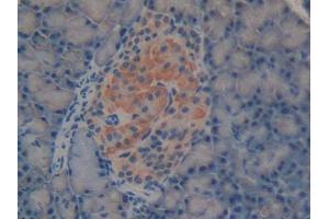 DAB staining on IHC-P; Samples: Rat Pancreas Tissue (Laminin alpha 1 anticorps  (AA 41-230))