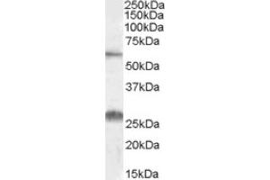 Image no. 1 for anti-Solute Carrier Family 47, Member 1 (SLC47A1) (Internal Region) antibody (ABIN375104)