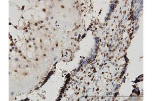 Immunoperoxidase of monoclonal antibody to SMAD7 on formalin-fixed paraffin-embedded human placenta.