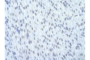 Rabbit Anti-HNRNPD Antibody       Paraffin Embedded Tissue:  Human cardiac cell   Cellular Data:  Epithelial cells of renal tubule  Antibody Concentration:   4.