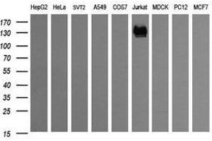 Image no. 2 for anti-CD163 (CD163) antibody (ABIN1497176) (CD163 anticorps)