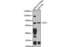 Western blot analysis of extracts of various cell lines, using IFIT3 antibody (ABIN1680389, ABIN3018293, ABIN3018295 and ABIN6220427) at 1:1000 dilution. (IFIT3 anticorps  (AA 128-331))
