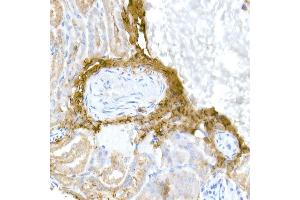 Immunohistochemistry of paraffin-embedded mouse kidney using Collagen I/COL1 Rabbit pAb (352) at dilution of 1:150 (40x lens).
