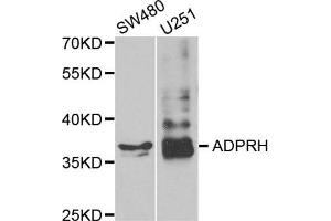 Western Blotting (WB) image for anti-ADP-Ribosylarginine Hydrolase (ADPRH) antibody (ABIN1980293)