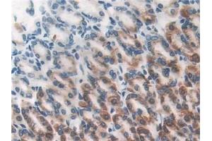 Detection of DLD in Rat Stomach Tissue using Polyclonal Antibody to Dihydrolipoyl Dehydrogenase (DLD) (DLD anticorps)