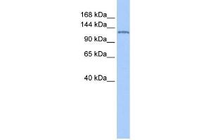 NUP155 antibody used at 1 ug/ml to detect target protein.