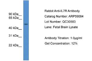 WB Suggested Anti-IL7R  Antibody Titration: 0. (IL7R anticorps  (Middle Region))