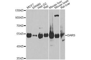 Western blot analysis of extracts of various cell lines, using DARS Antibody.