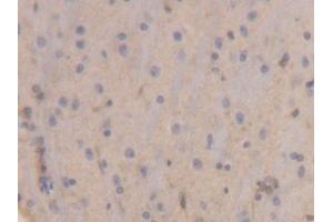 DAB staining on IHC-P; Samples: Rat Brain Tissue